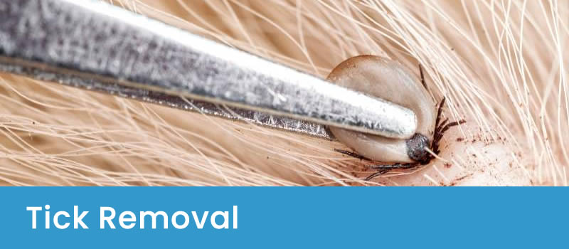 Removing tick with tweezers Tick Pest Control Service Canberra